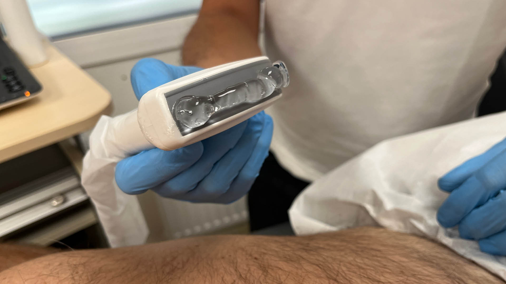 Neutral_Physiotherapie_Beckenboden Mann Ultraschalluntersuchung Bild 2_praxis entero Ultraschalluntersuchung Beckenboden Graz