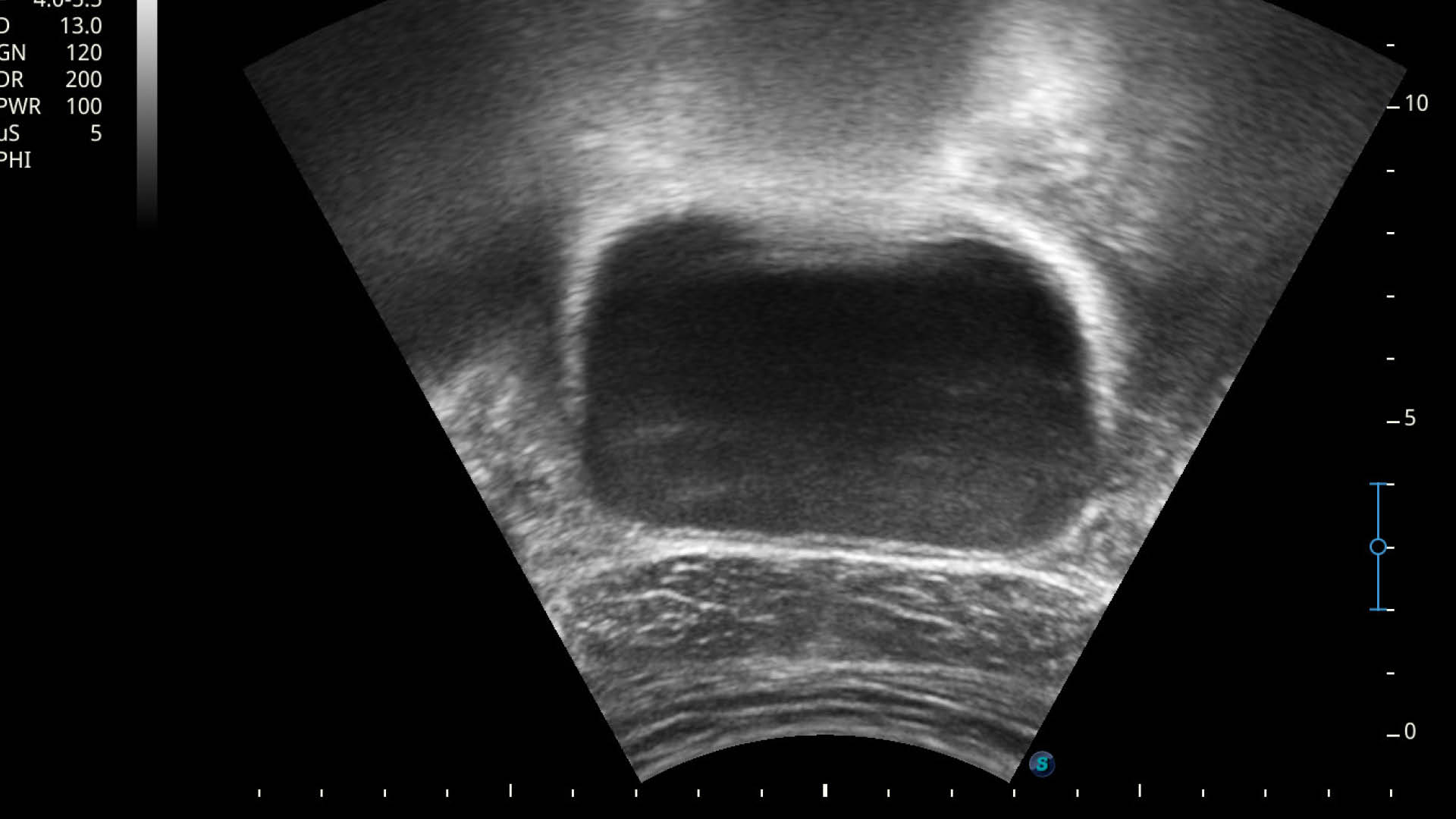 Neutral_Physiotherapie_Blase Mann Ultraschallbild_praxis entero